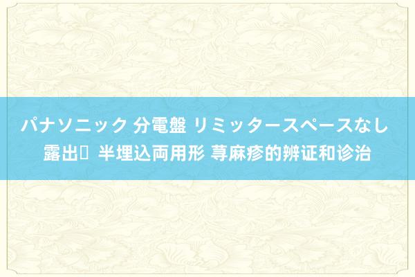 パナソニック 分電盤 リミッタースペースなし 露出・半埋込両用形 荨麻疹的辨证和诊治